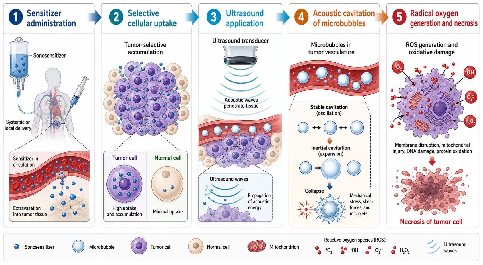 The sonodynamic cascade: sensitizer administration, selective cellular uptake, ultrasound application, acoustic cavitation of microbubbles, and resulting radical-oxygen-induced necrosis. © 2026 ImmunoTherapy Japan. Educational use only